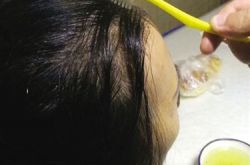 土豆皮煮沸可以变成染发剂？ 记者试验告诉您
