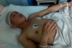 被车撞昏迷 怕亲人担心 不去医院先回家 脑出血 聂建东悬赏寻找肇事者